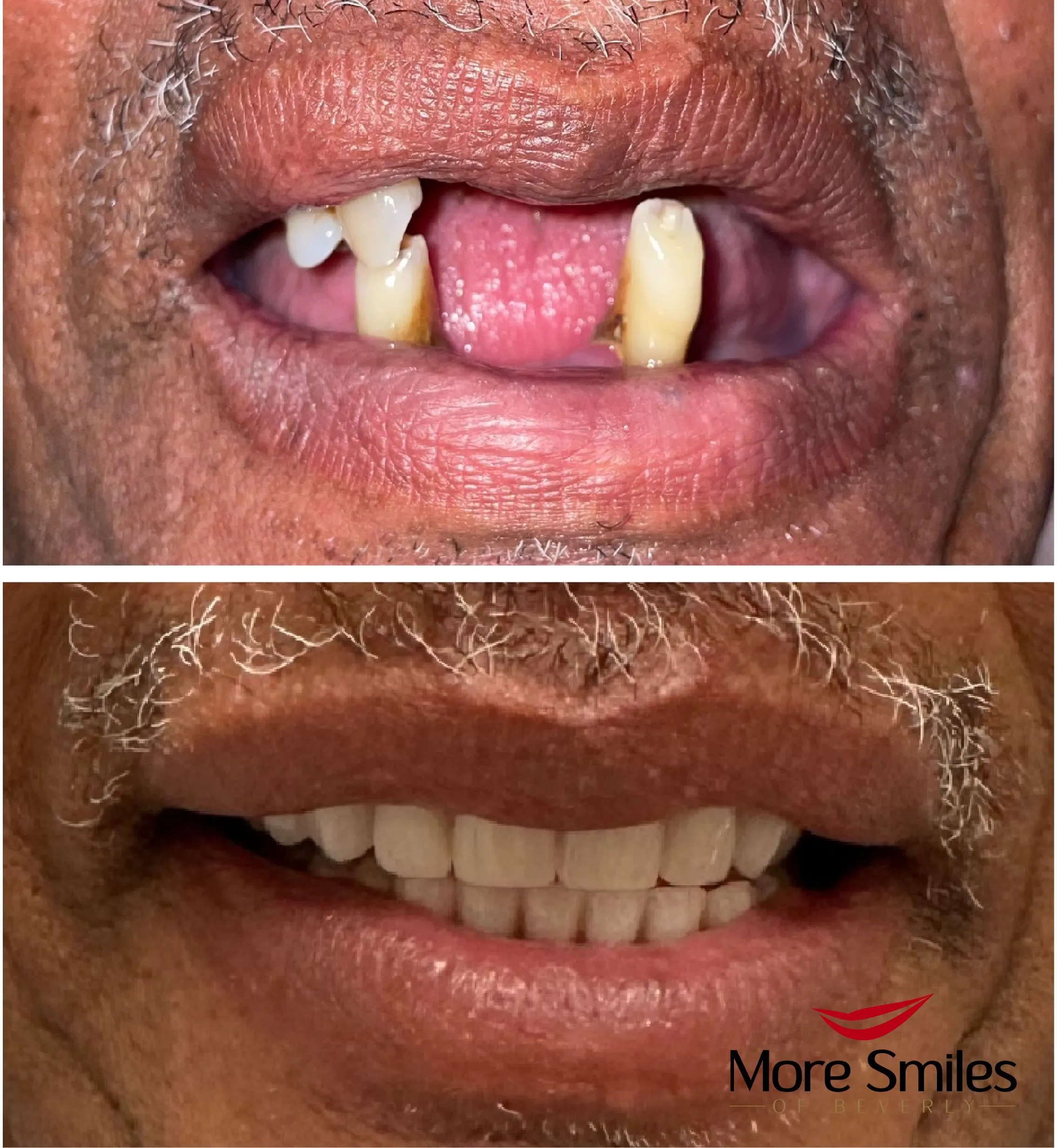 Beforeandafter.jpg