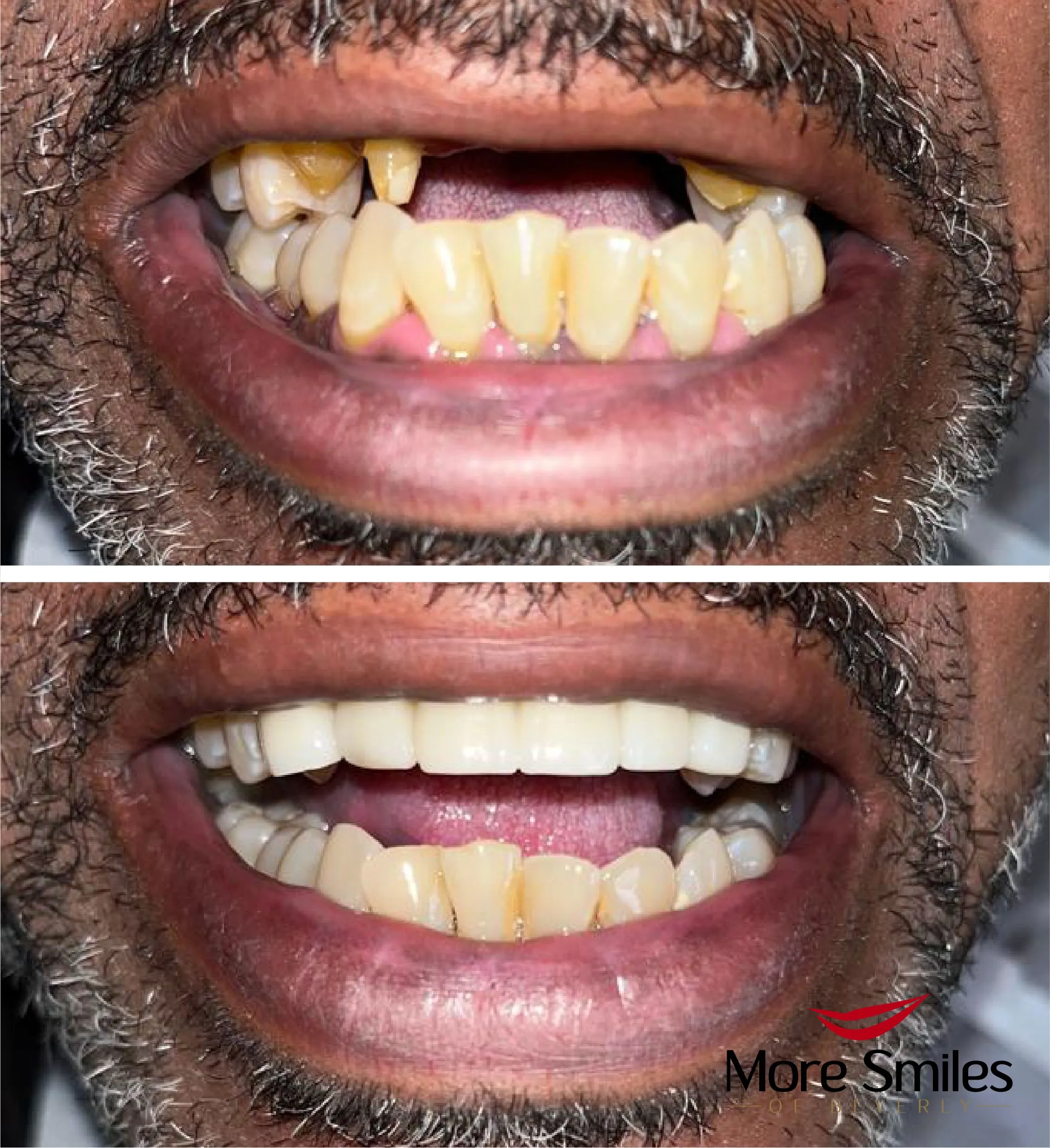 before-after-104.jpg