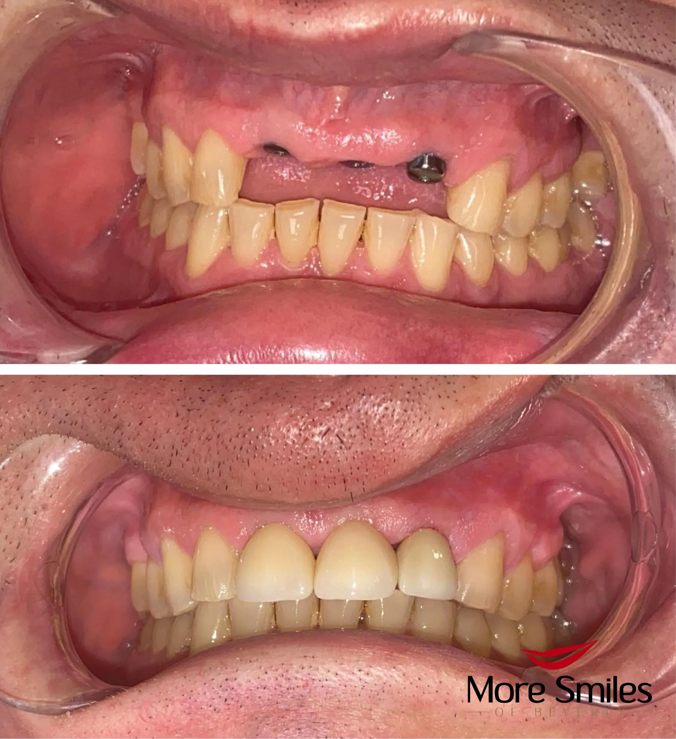 before-after-1042.jpg