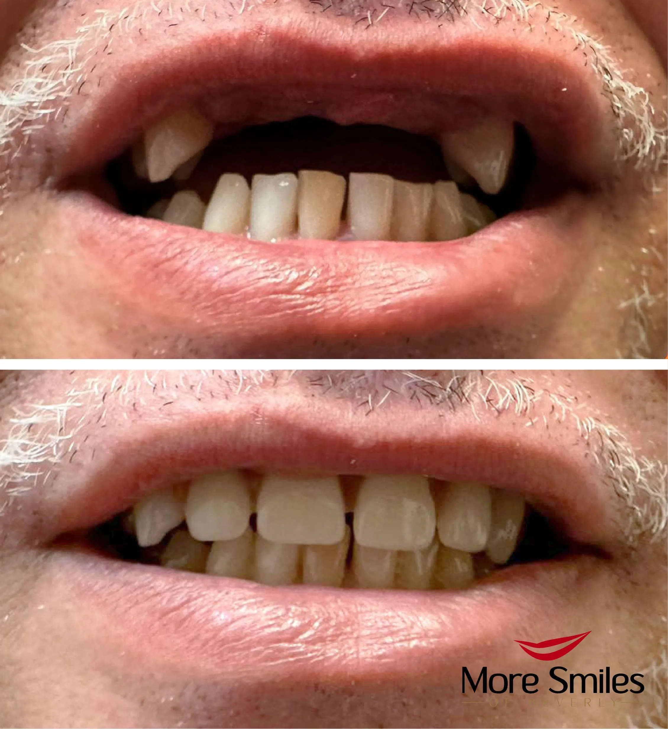 before-after-2-24-23.jpg
