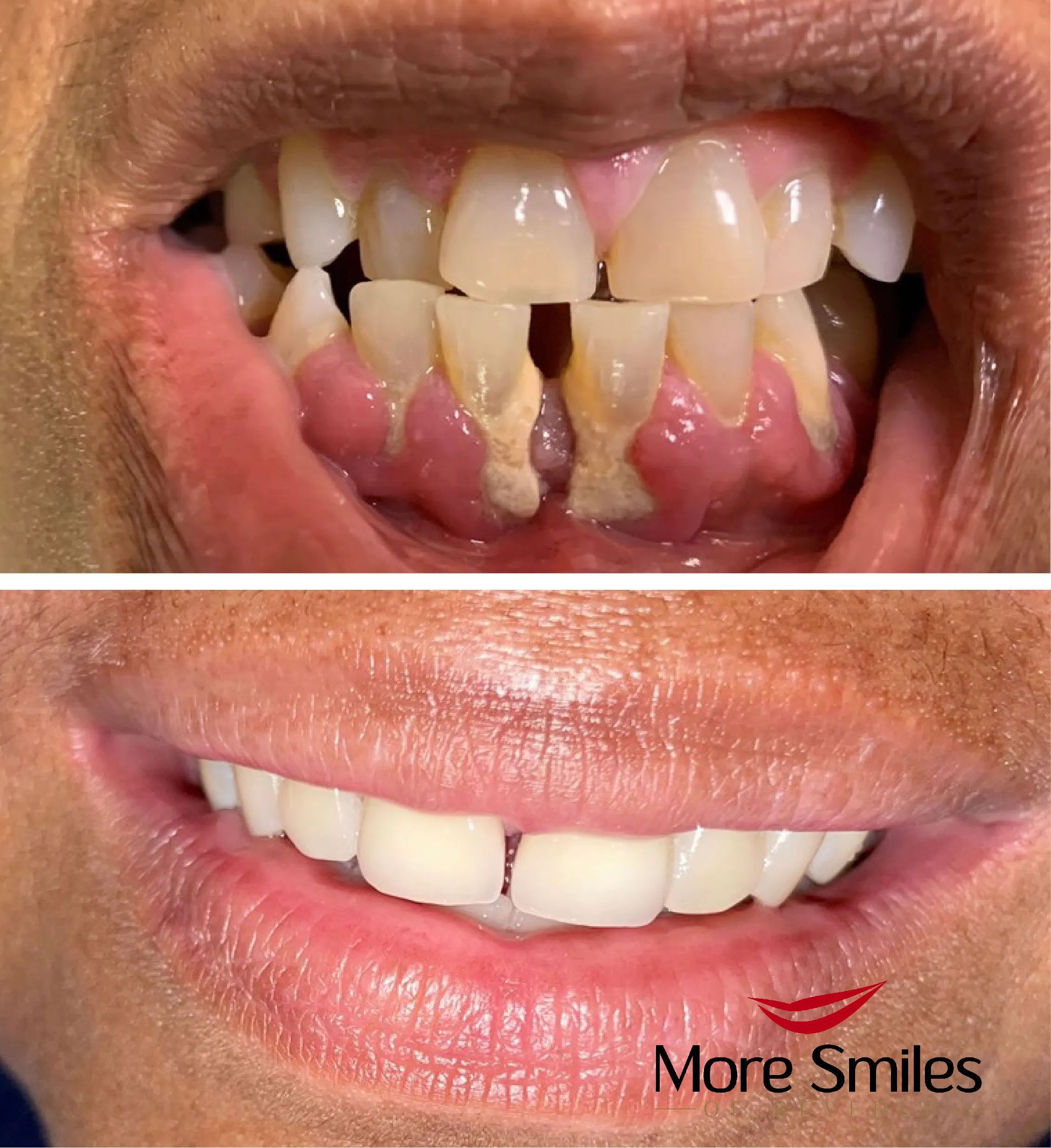 beforeafter-1.jpg