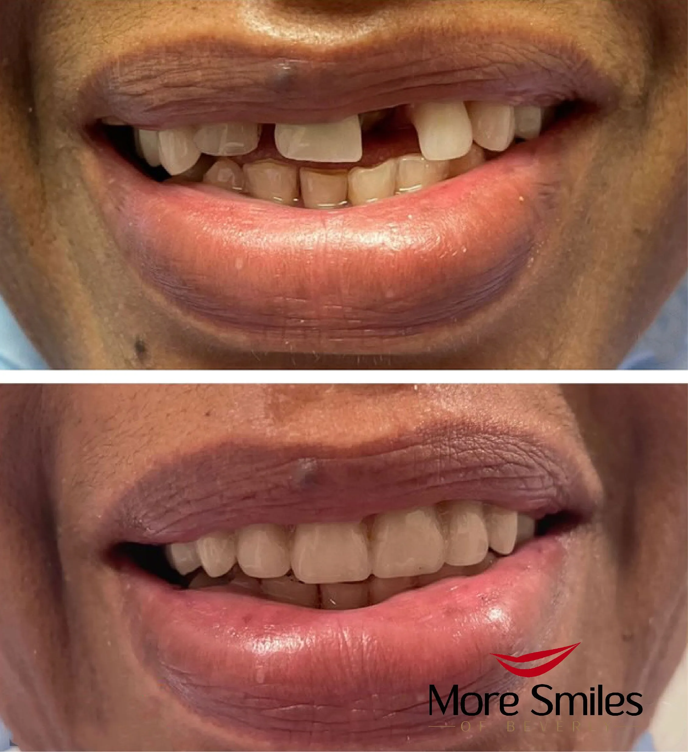 beforeafter-3.jpg