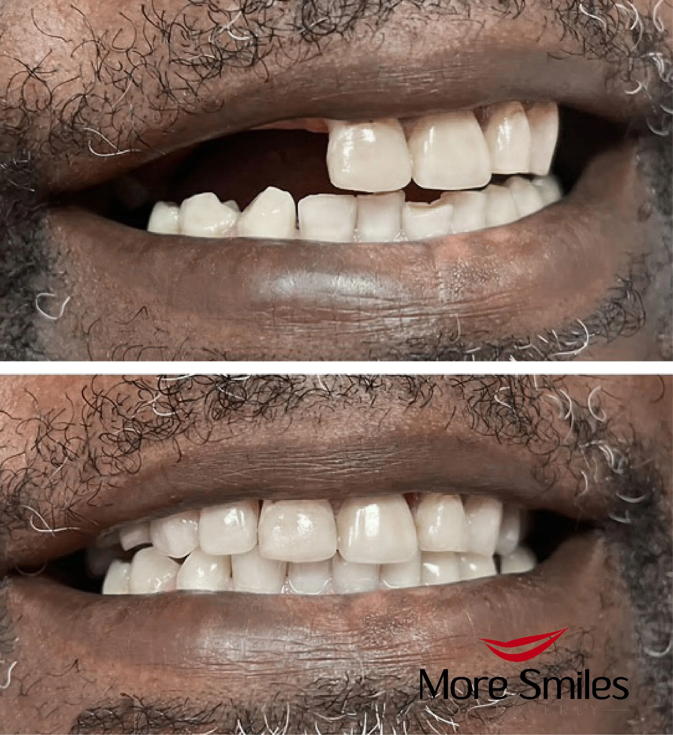 beforeafter-3use.jpg