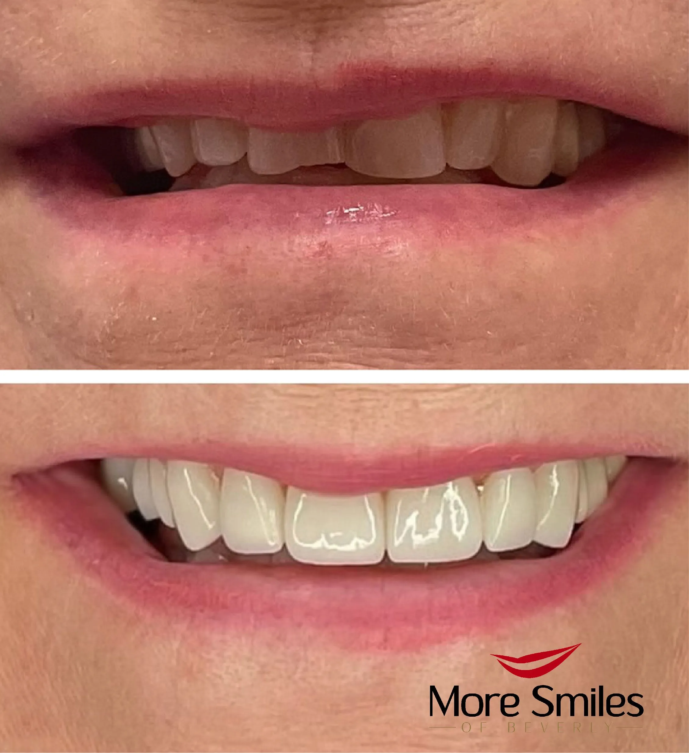 beforeafter-5.jpg